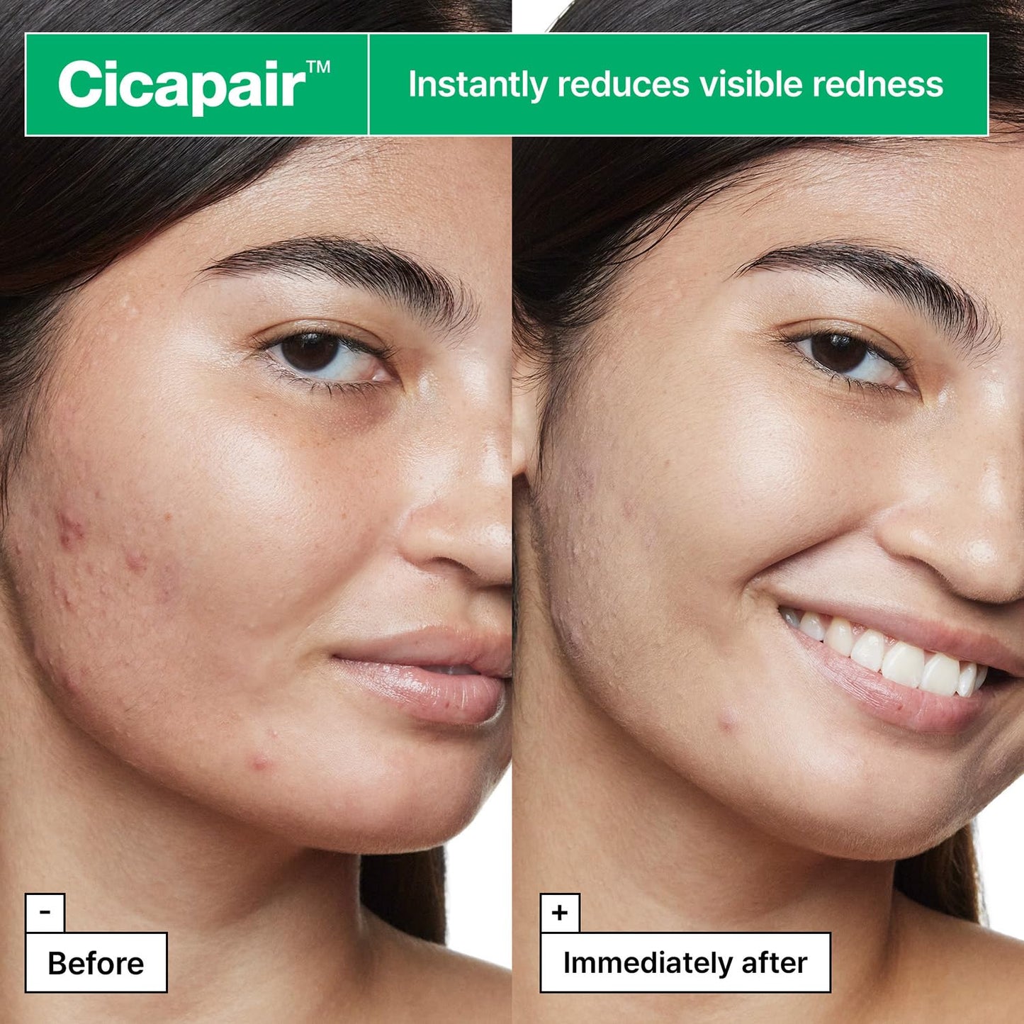 Cicapair™ Tiger Grass Camo Drops Tinted Face Serum SPF 35 with Centella Asiatica | Cc Cream | Korean Skin Care, 1.01 Fl Oz