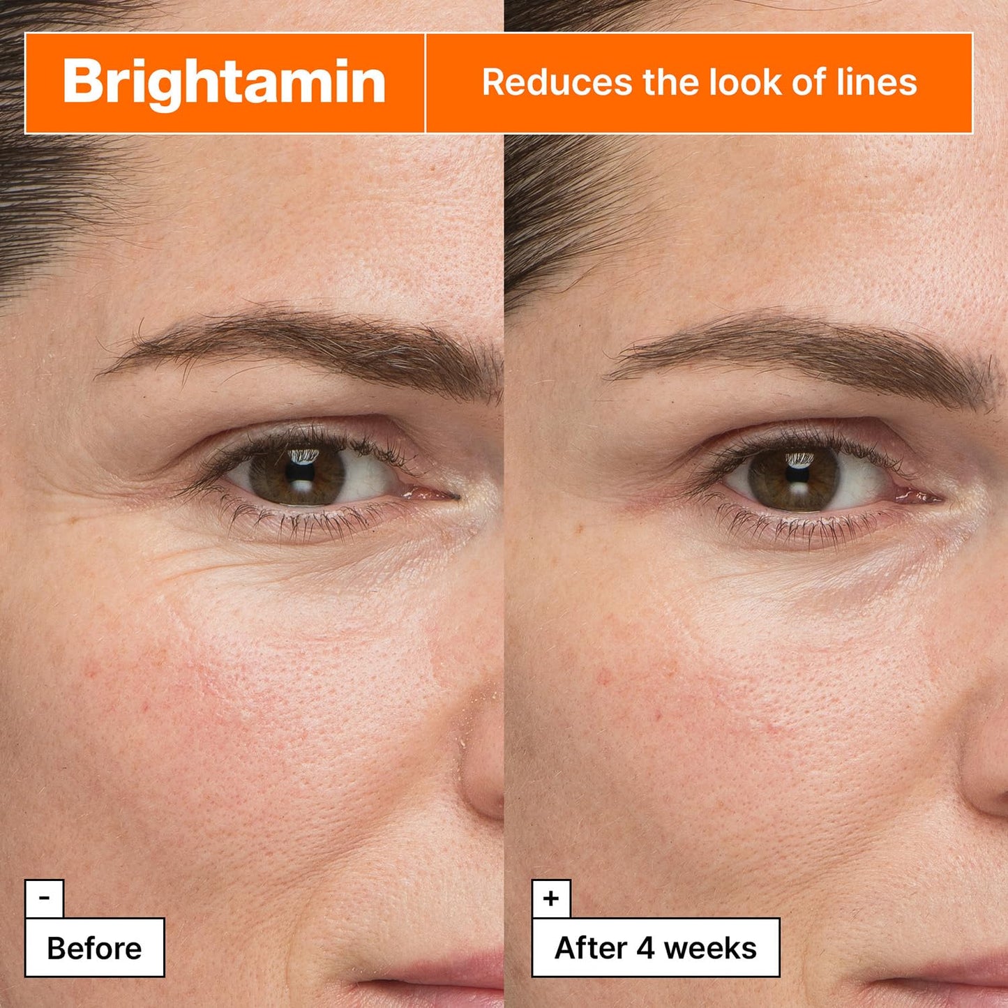 Dr.Jart+ Brightamin Brightening Korean Serum For Visible Fine Lines with Vitamin C and Niacinamide | Korean Skin Care, 0.27 Fl Oz