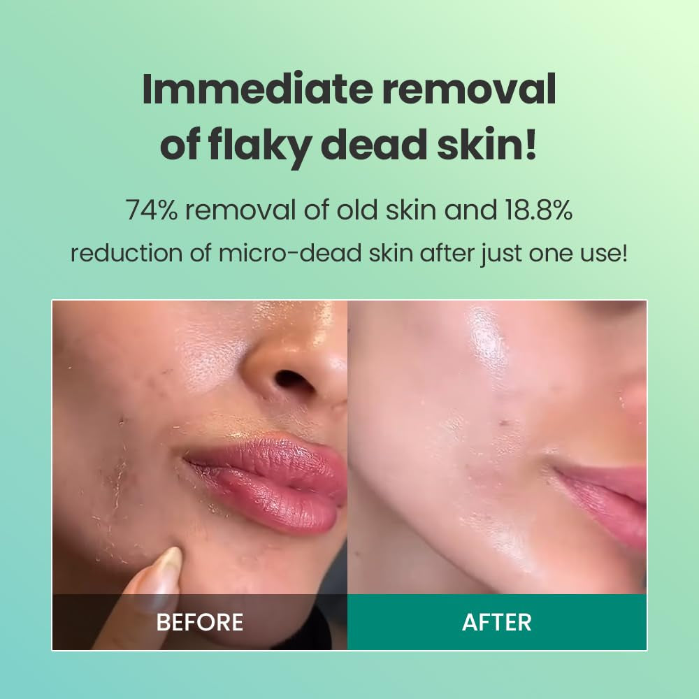 Brightening Peeling Gel (120Ml)