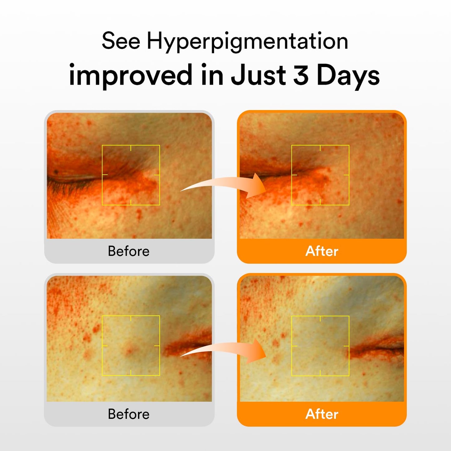 Glutathiosome Dark Spot Serum Vita Drop 1.69 Fl.Oz. | Korean Skincare, Dark Spot, Hyperpigmentation Treatment | Brightening Serum for Sensitive, Uneven Skin | Niacinamide, Viatmin C