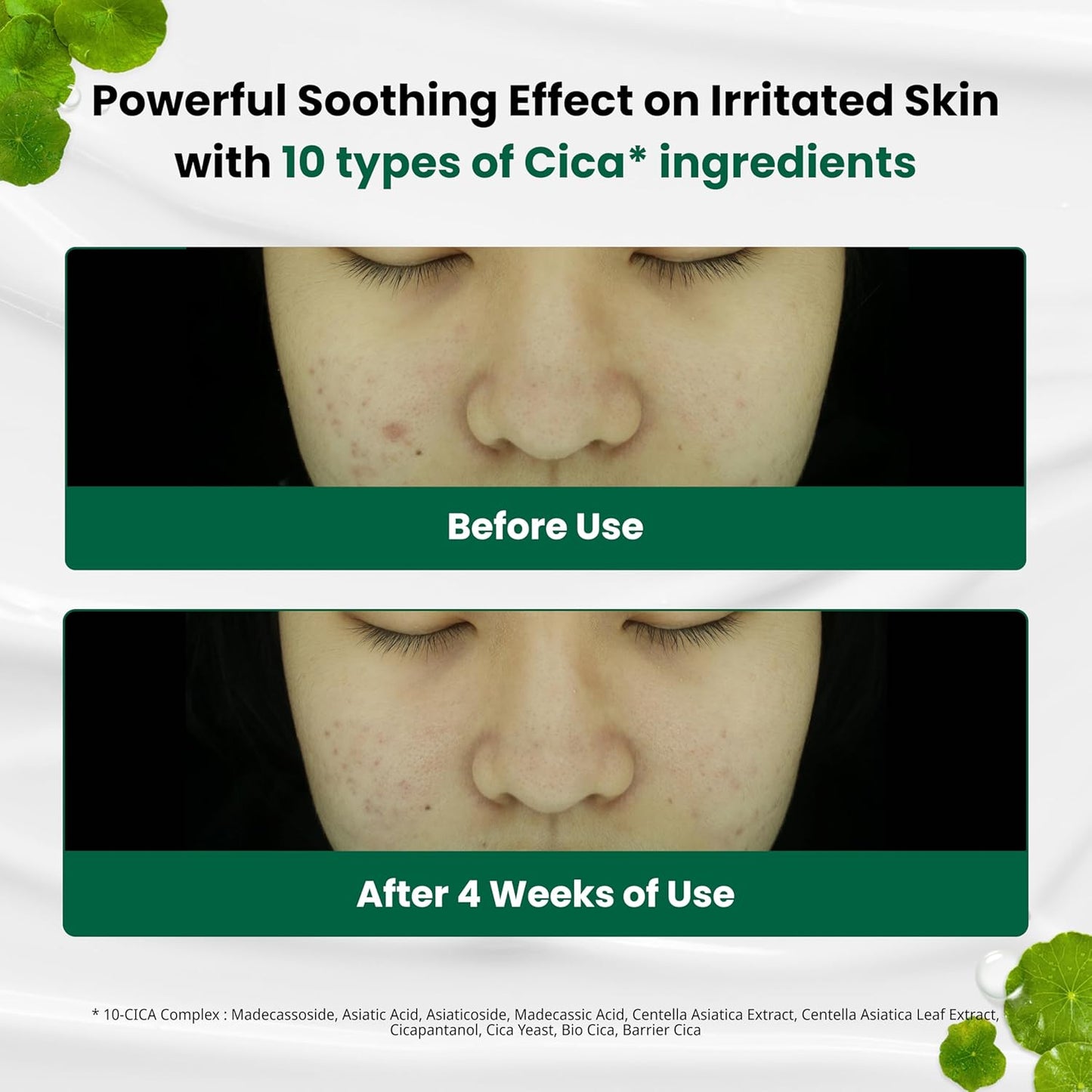 Red Blemish Clear Soothing Korean Moisturizer Face Cream, 70Ml - Cica Cream, Korean Skin Care Moisturizer, Korean Face Moisturizer, Facial Moisturizer, Korean Skincare, K Beauty Skincare Coreano