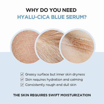 Hyalu-Cica Blue Serum 1.69 Fl.Oz, 50Ml, 5 Layer Hyaluronic Acid Cica Niacinamide, Hydrating and Refreshing Multi-Care Solutions