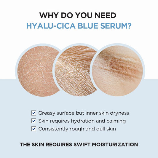 Hyalu-Cica Blue Serum 1.69 Fl.Oz, 50Ml, 5 Layer Hyaluronic Acid Cica Niacinamide, Hydrating and Refreshing Multi-Care Solutions