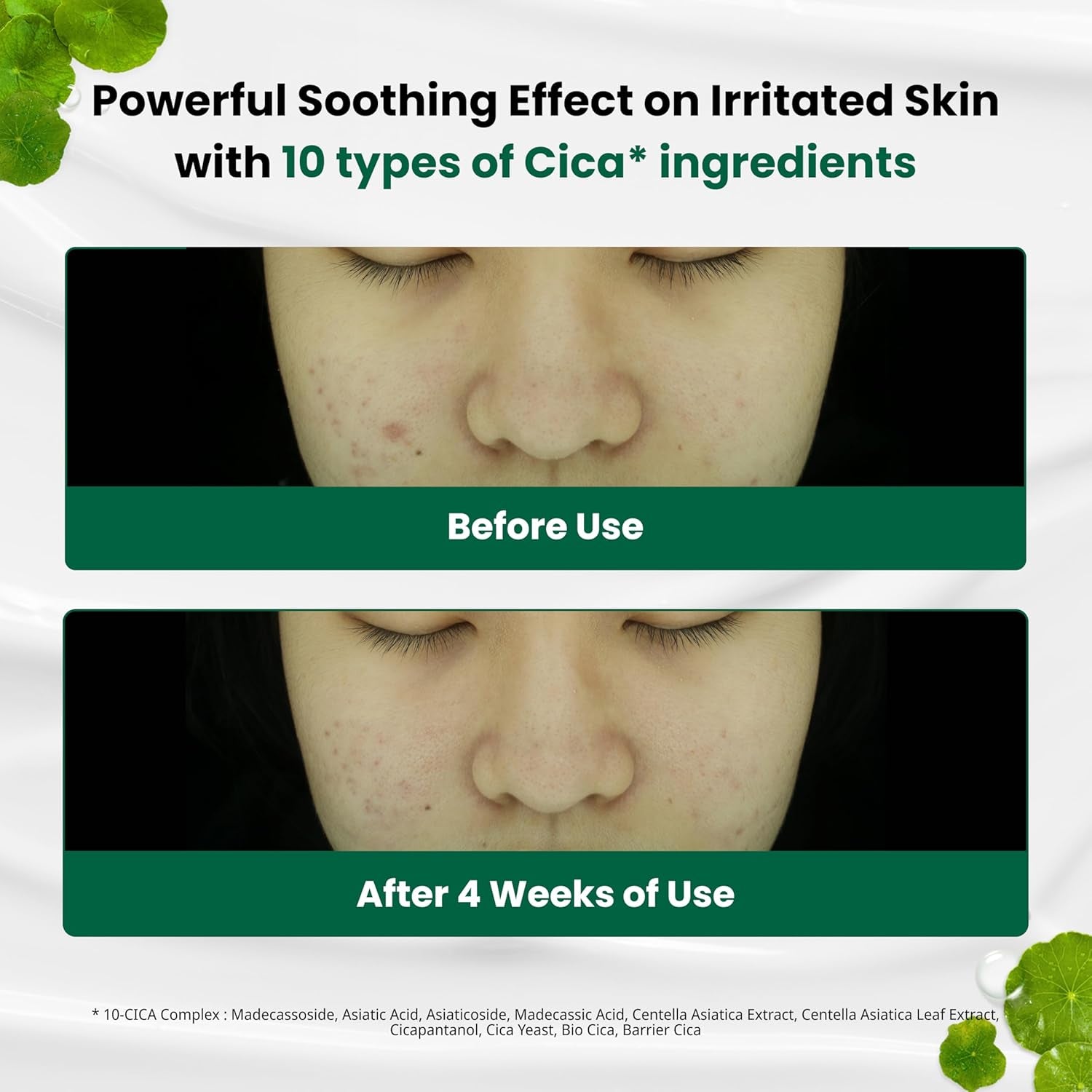 Red Blemish Clear Soothing Korean Moisturizer Face Cream, 70Ml - Cica Cream, Korean Skin Care Moisturizer, Korean Face Moisturizer, Facial Moisturizer, Korean Skincare, K Beauty Skincare Coreano
